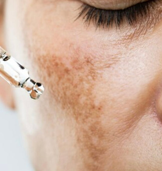 Say Goodbye to Dark Spots: The Ultimate Guide to Clear, Radiant Skin